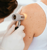 afectiuni-ale-pielii